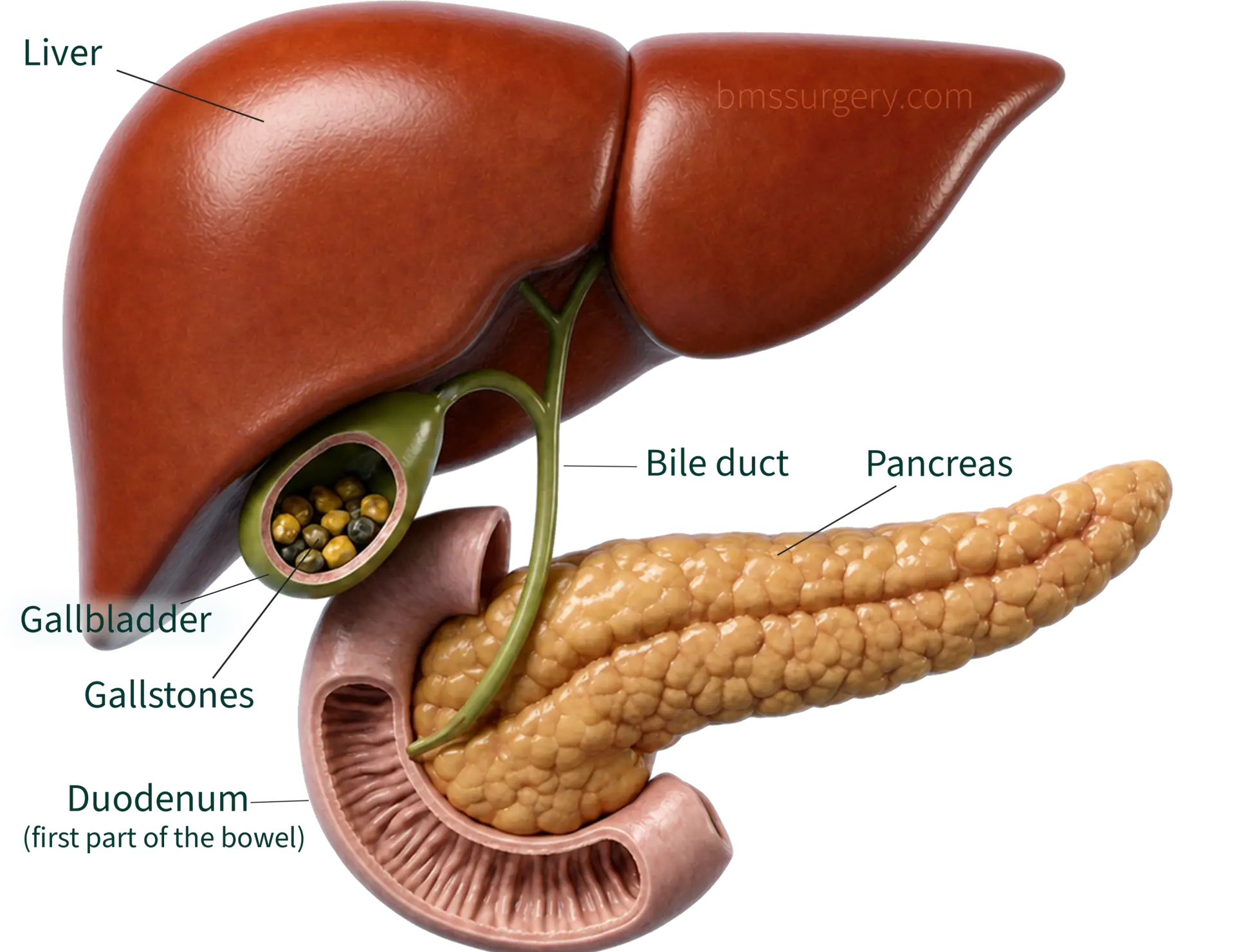 gallbladder gallstone anatomy